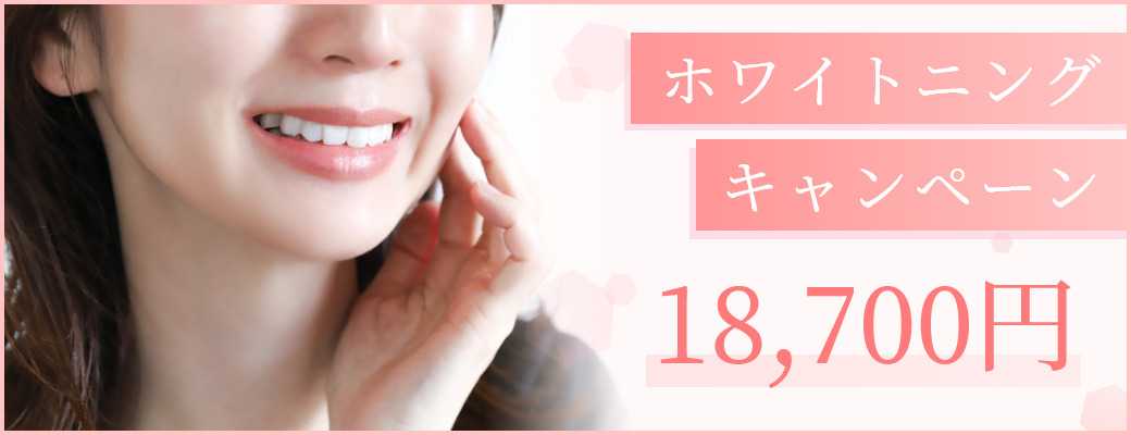 ホワイトニングキャンペーン
